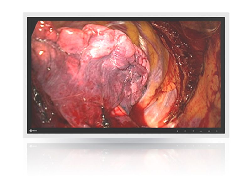 Eizo RadiForce EX270W 27" FHD Surgical LCD Monitor