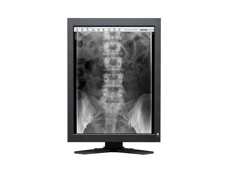 Eizo RadiForce GS220 2MP Diagnostic Radiology Monitor
