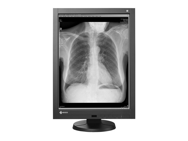 Eizo RadiForce GS310 3MP Diagnostic Radiology Monitor