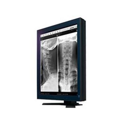 Eizo RadiForce GX220-BK 2MP Grayscale Diagnostic Monitor