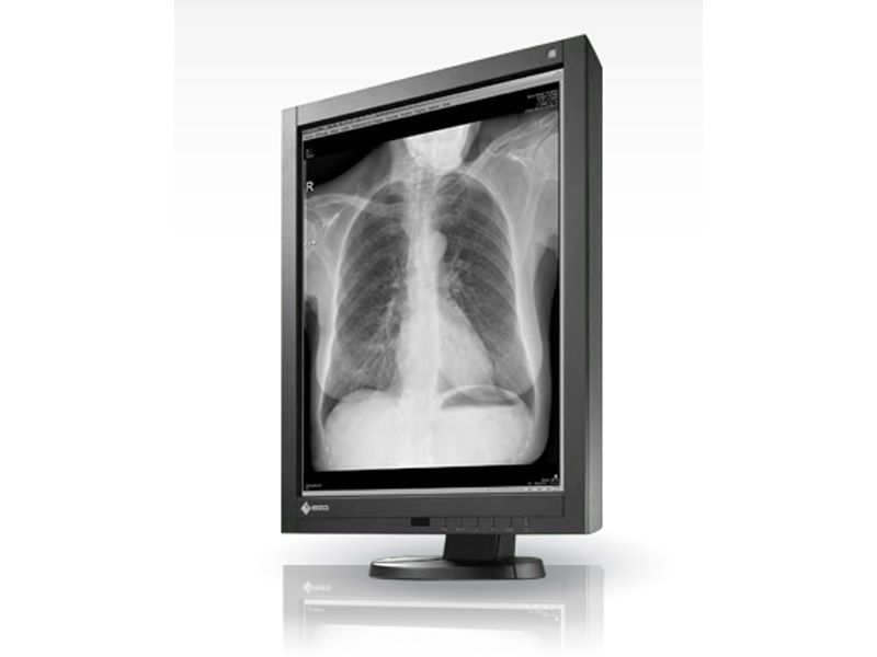 Eizo RadiForce GX340 3MP Diagnostic Radiology Monitor