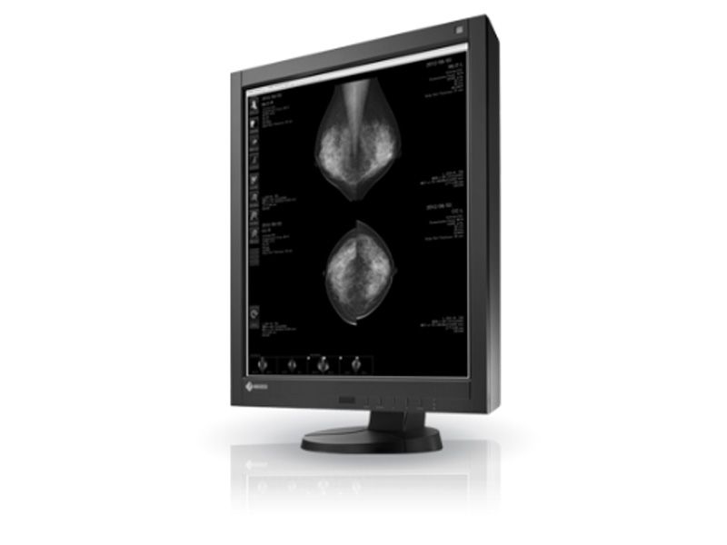 Eizo RadiForce GX540 5MP Mammography Monitor