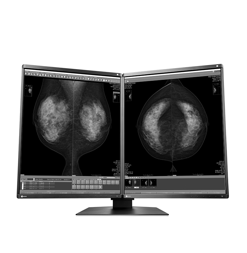 Eizo RadiForce GX570-BK-MD MammoDuo mammography monitor product photo