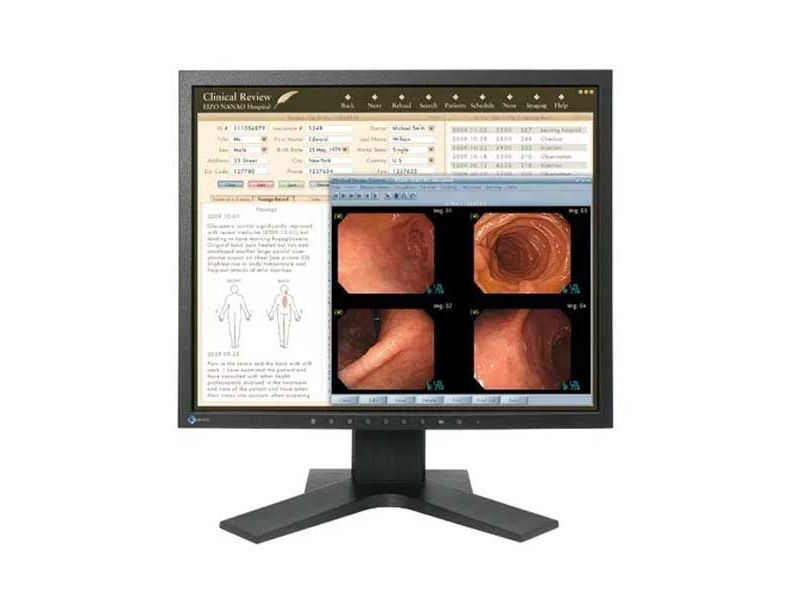 Eizo MX193-BK 1MP Clinical Review Display Monitor