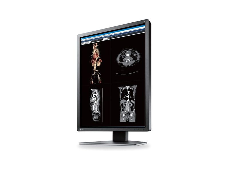 Eizo MX216-BK 2MP Clinical Review Display Monitor