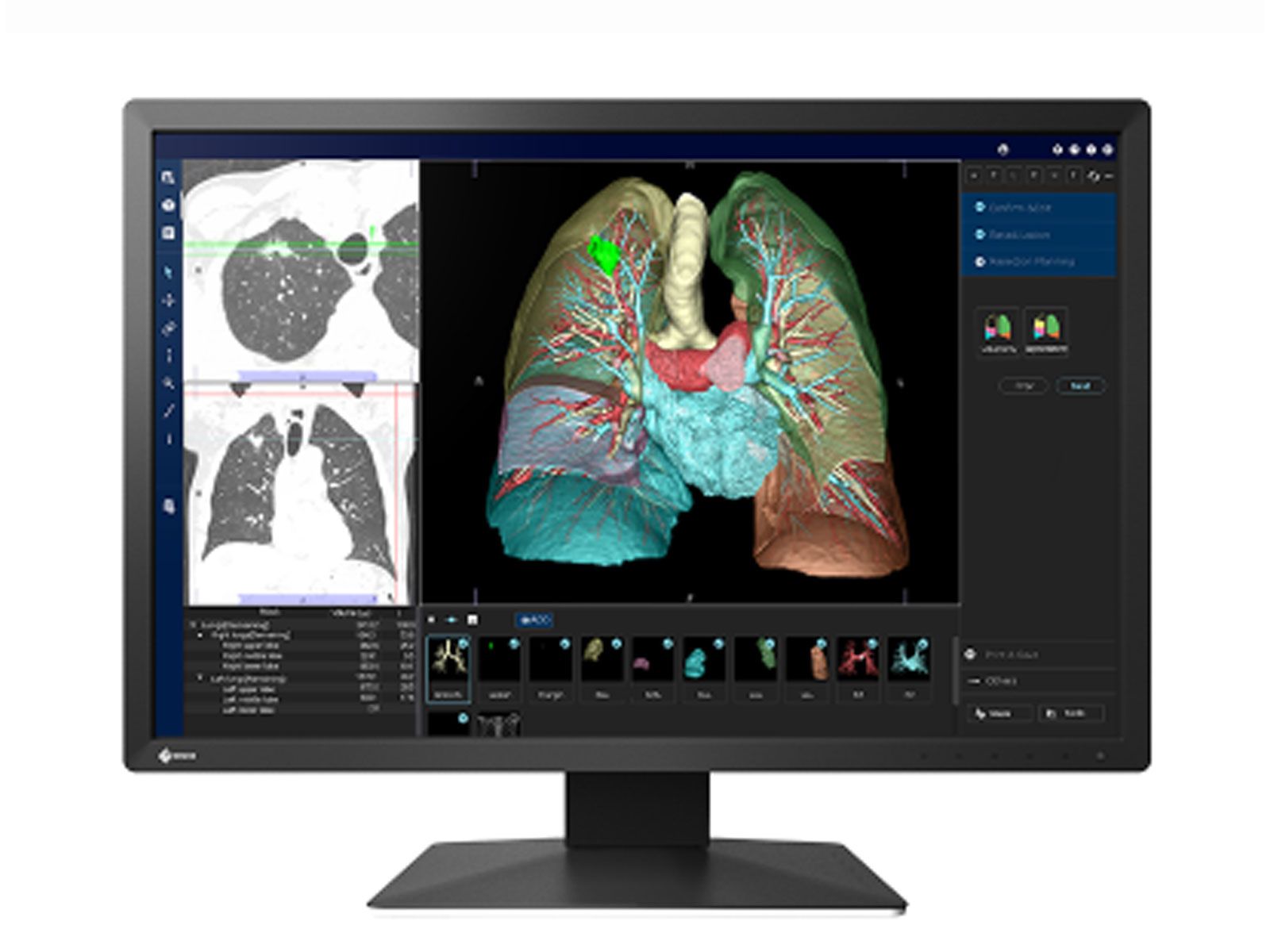 Escco Monitor Eizo MX243W 2.3MP Clinical Review Display Monitor – Ampronix