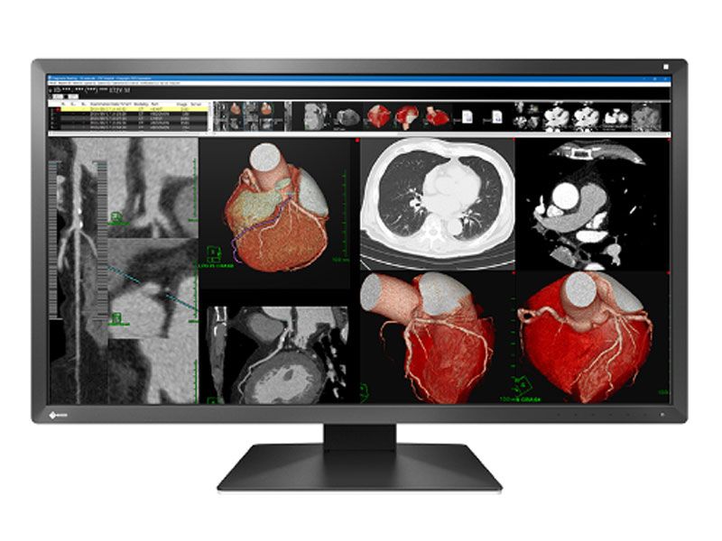 Eizo MX317W 8MP Clinical Review Display Monitor