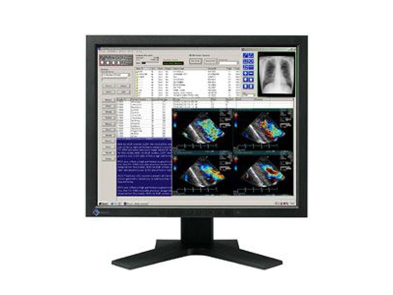 EIZO R11 1MP Monitor