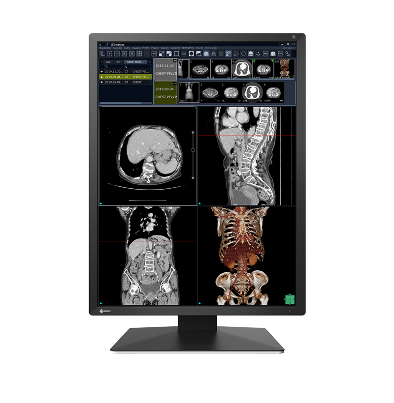 Eizo RadiForce RX270-BK 21.3 inch 2MP color diagnostic radiology monitor