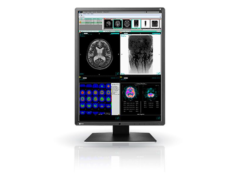 Eizo RadiForce RX350 3MP Diagnostic Radiology Monitor
