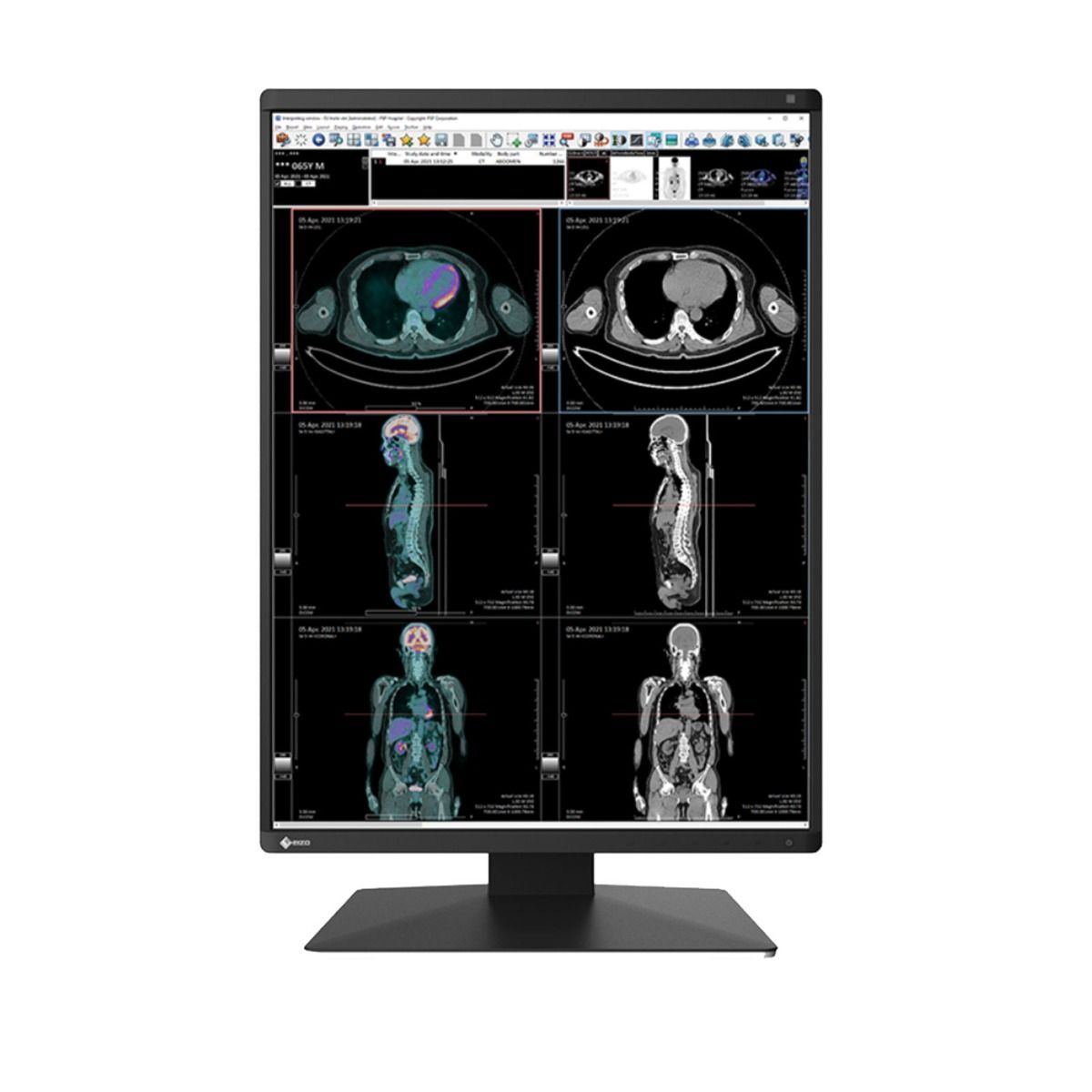 Eizo RX370 3MP Diagnostic Radiology Monitor