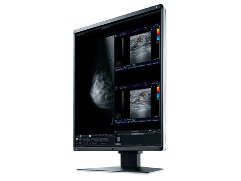 Eizo RX560 5MP Mammography Diagnostic Radiology Monitor