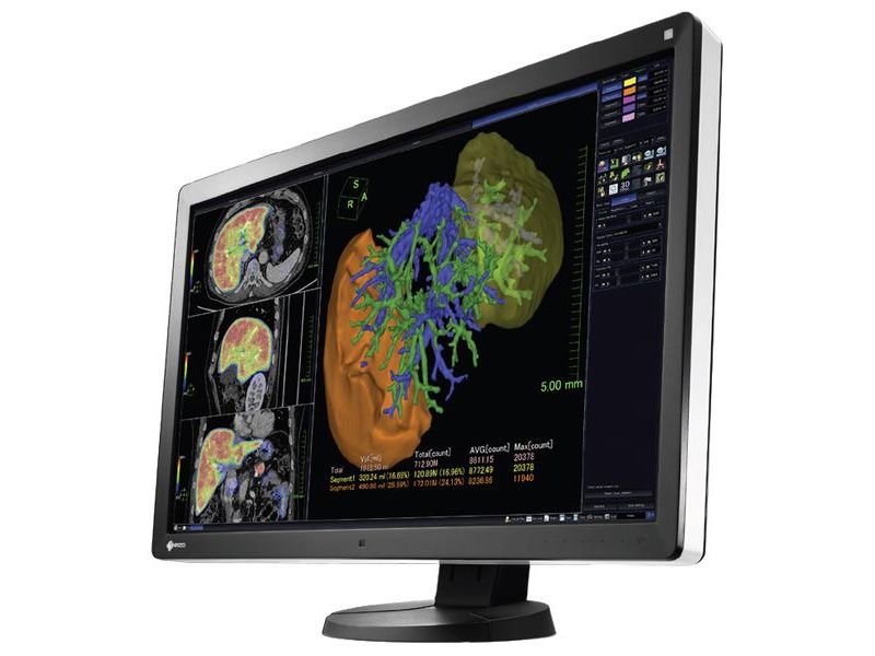 Eizo RX650 6MP PACS Diagnostic Radiology Monitor – Ampronix