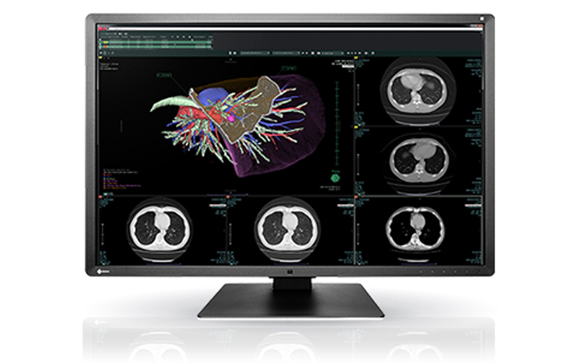Eizo RX660-BK RadiForce 6MP Radiology Monitor