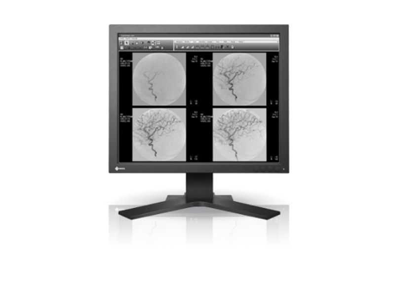 Eizo SMD 19102 D 1MP Grayscale Monitor
