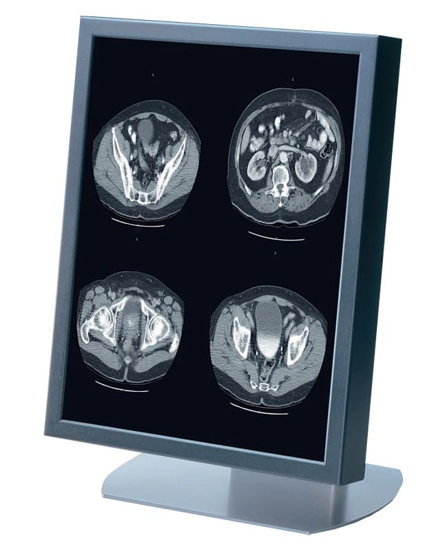 Siemens SMD 21306 D 3MP Grayscale Diagnostic Monitor