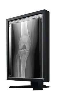 Eizo RadiForce G22 2MP Grayscale Display Monitor