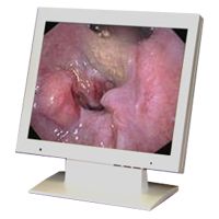 Philips E150B 15" XGA Surgical LCD Monitor