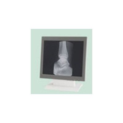 Philips 9919 320 50615 LCD Display