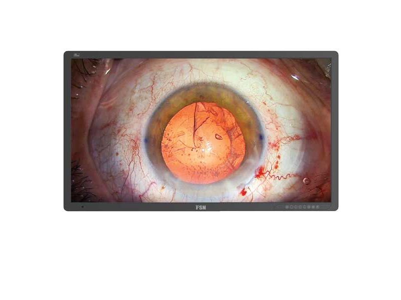 FSN FM-A5505DGC 55" 4K UHD 3D/2D Surgical LCD Monitor