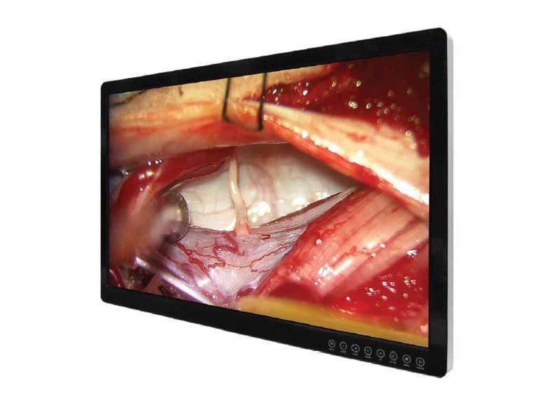 FSN FM-E3204DGC 32" 4K 3D/2D Surgical Monitor