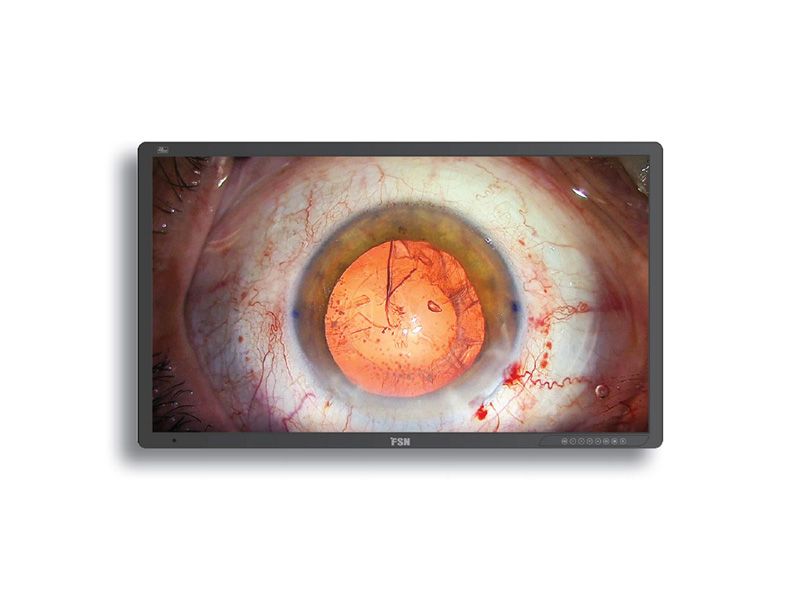 FSN FM-A5503DC 55" 4K UHD 3D/2D Surgical LCD Monitor