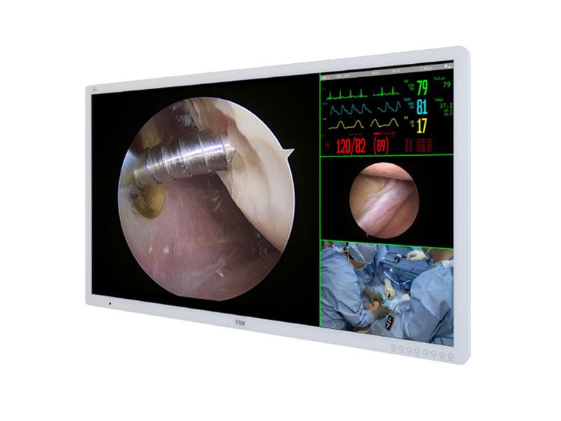 FSN FM-A5504DG 55" 4K UHD Surgical LCD Monitor