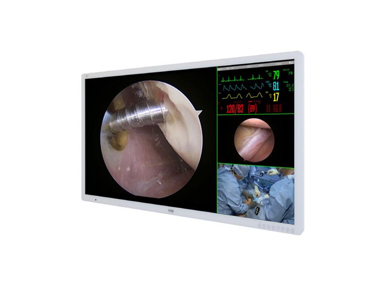 FSN FM-A5504DS 55" 4K UHD Surgical LCD Monitor