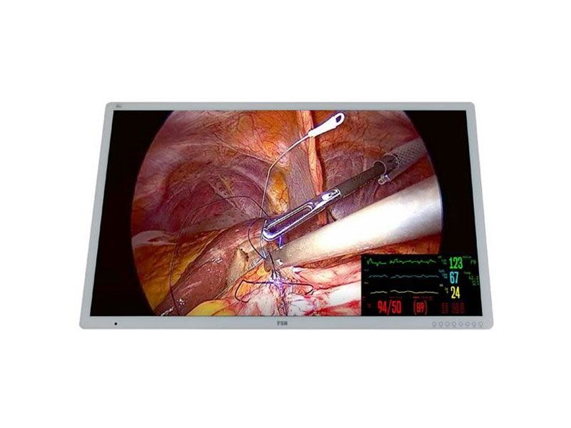 FSN FM-C5501DG 55" 4K UHD Surgical LCD Monitor