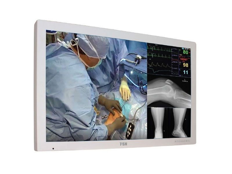 FSN FM-D5801DV 58" 4K UHD Surgical LCD Monitor