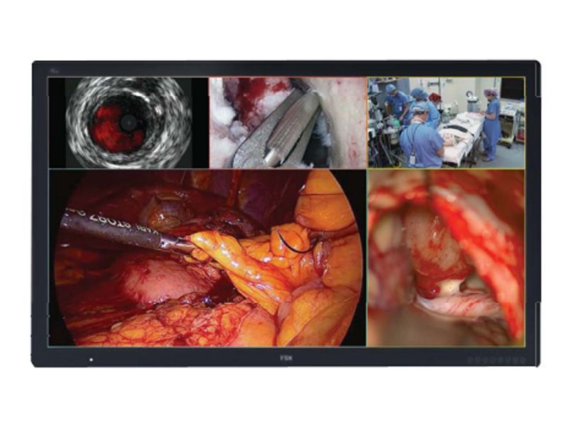FSN FM-D5802DV 58" 4K UHD Surgical LCD Monitor