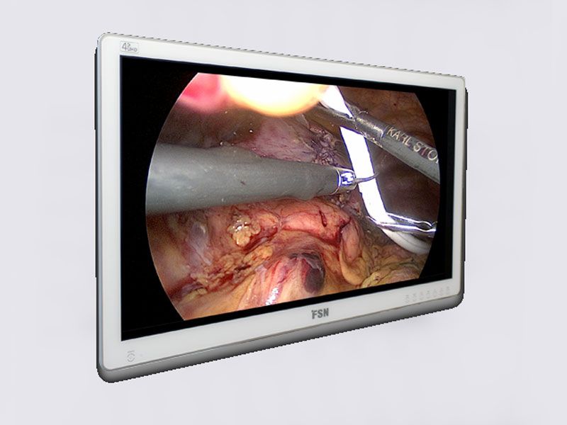 FSN FM-F2701D 27" 4K UHD OLED Surgical LCD Monitor