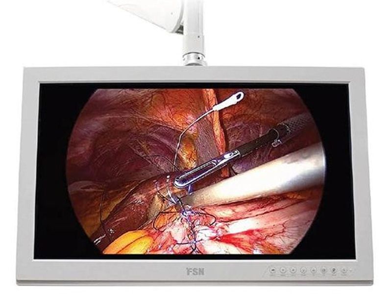 FSN FS-P3101D 31" 4K UHD Surgical LCD Monitor