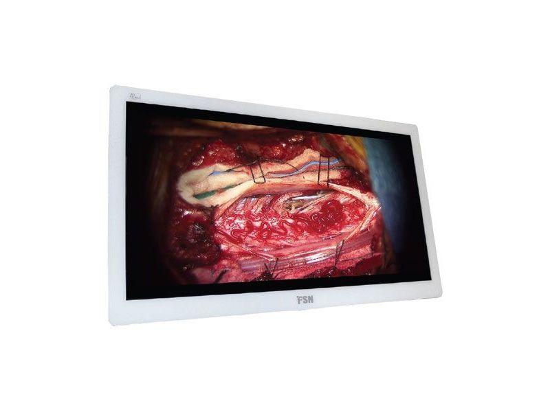 FSN FS-P3102D 31" 4K Surgical LCD Monitor - Repair