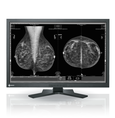 Eizo RadiForce GX1030-CL 10MP Diagnostic Radiology Monitor