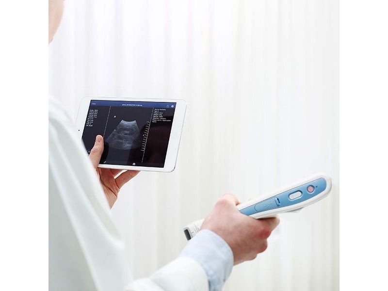 HEALCERION SONON 300C Wireless, Wi-Fi Ultrasound Convex Probe
