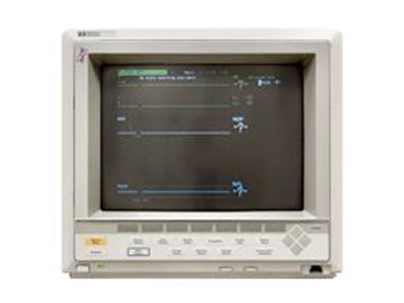 HP M1094B Monitor