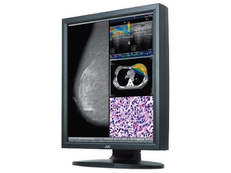 JVC CCL550i2 5MP Diagnostic Radiology Monitor