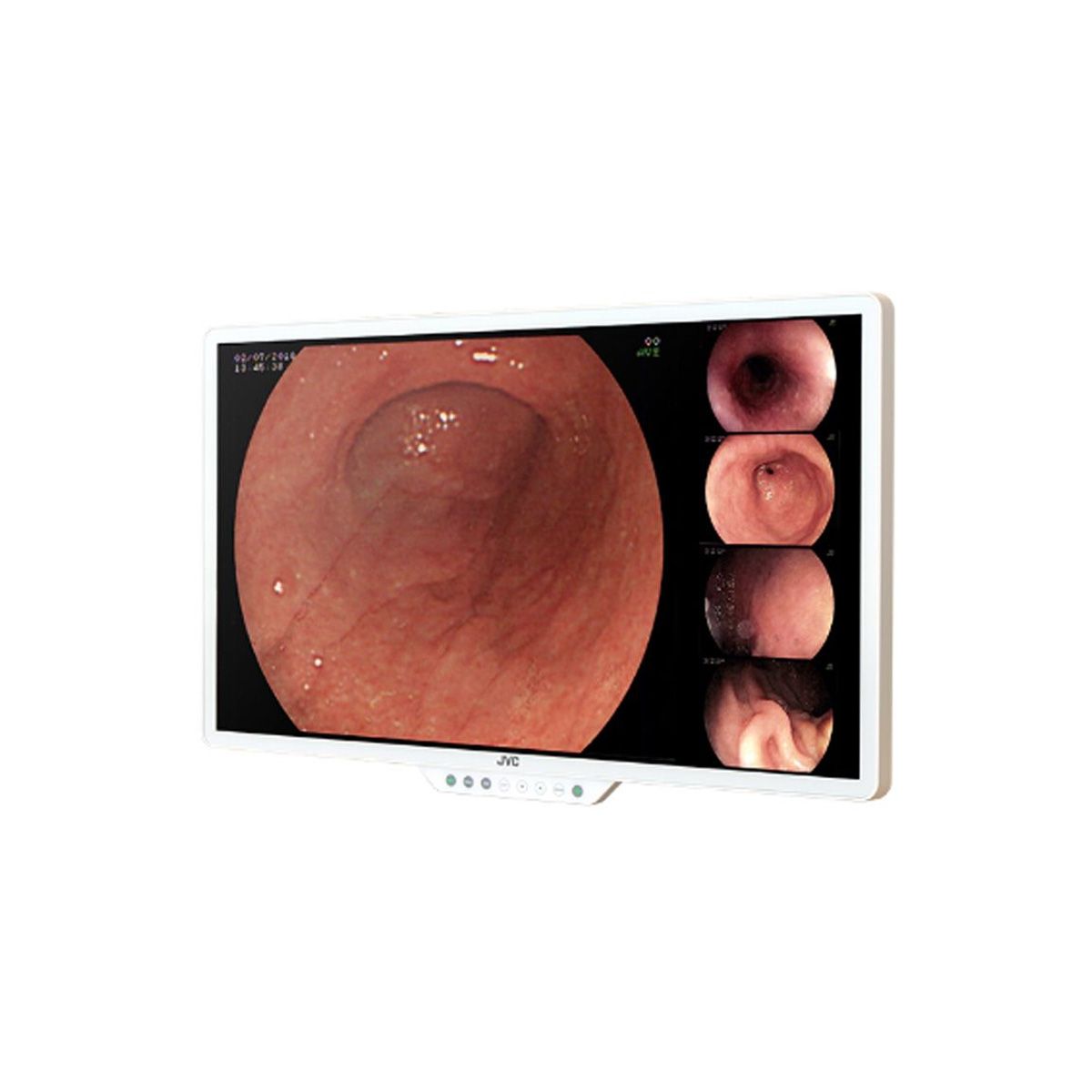 JVC CL-E270 27" FHD Surgical LCD Monitor