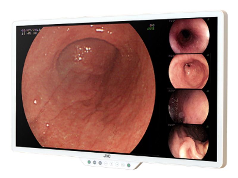 JVC CL-E270 27" FHD Surgical LCD Monitor