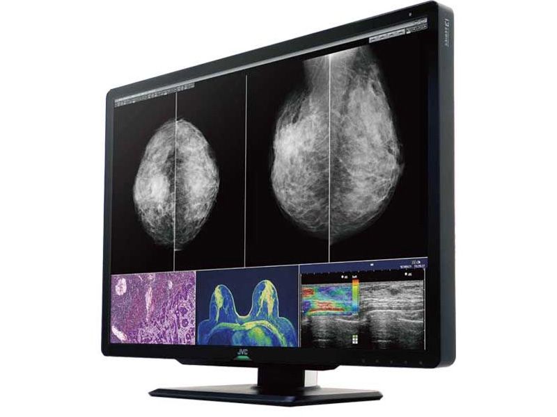 JVC CL-S1200 12MP Diagnostic Radiology Monitor