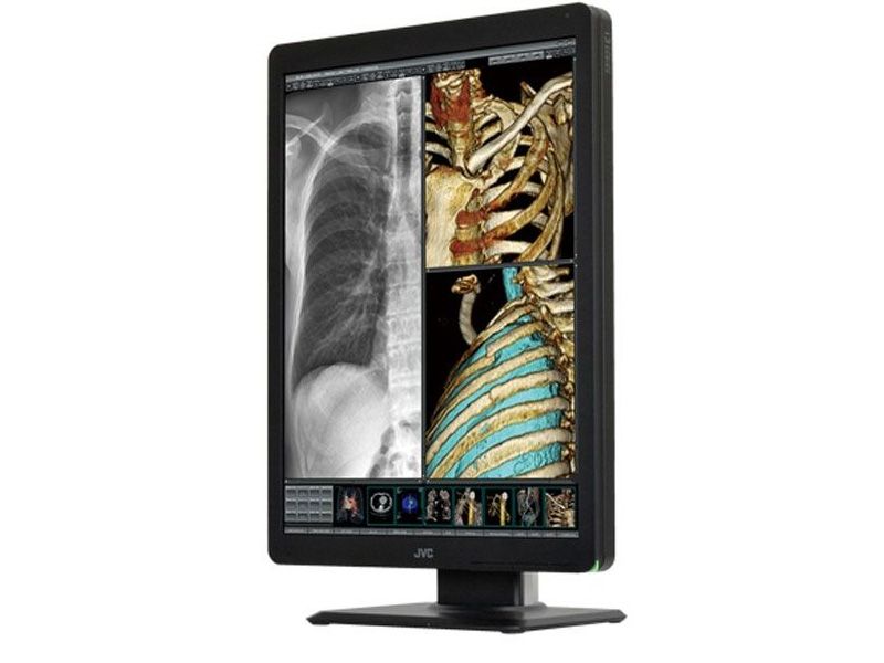 JVC CL-S200 2MP Diagnostic Radiology Monitor