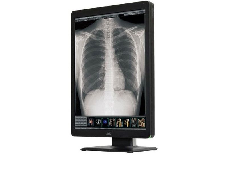JVC CL-S300 3MP Diagnostic Radiology Monitor
