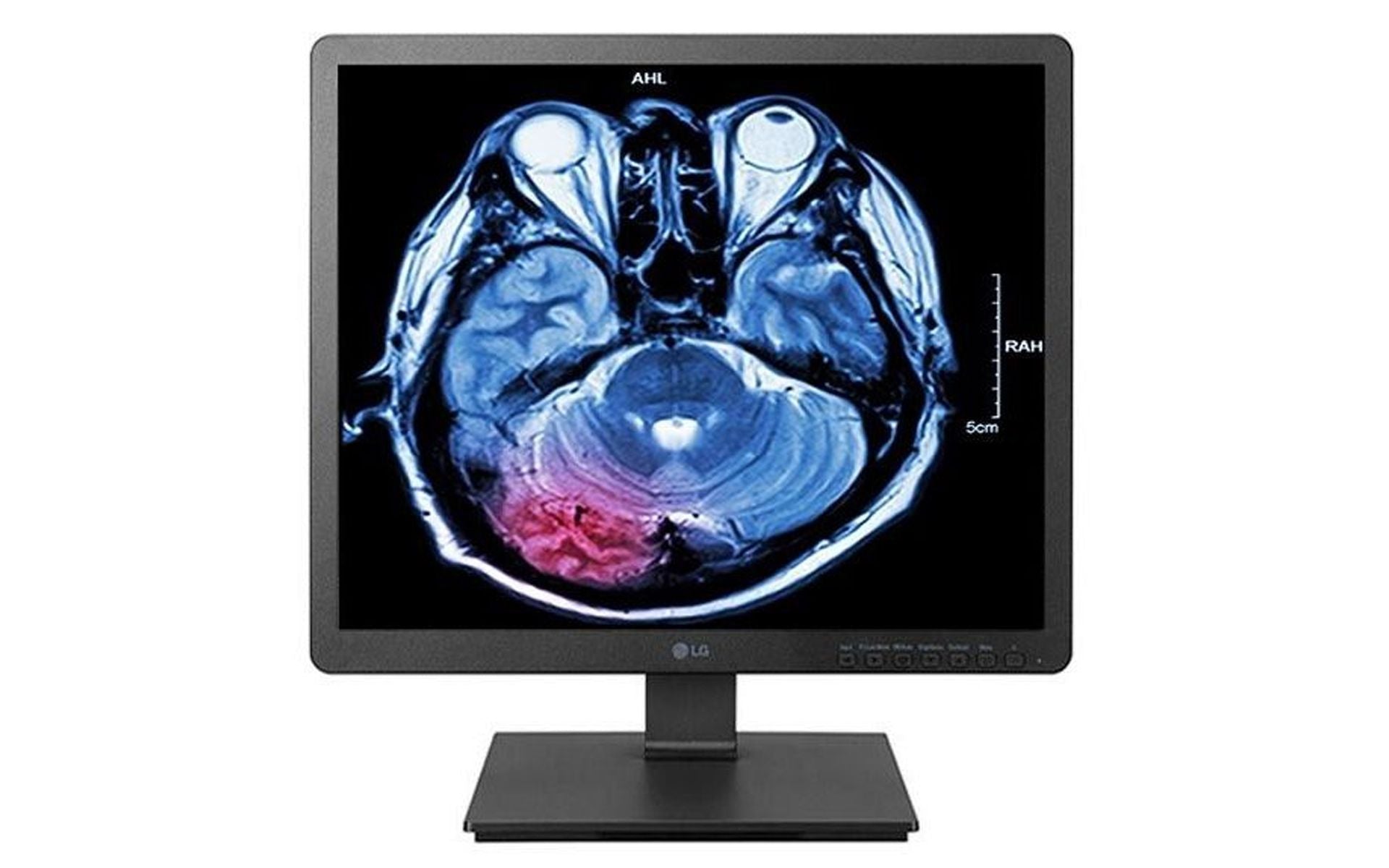 LG 19HK312C-B 1.3 MP Clinical Review Display Monitor