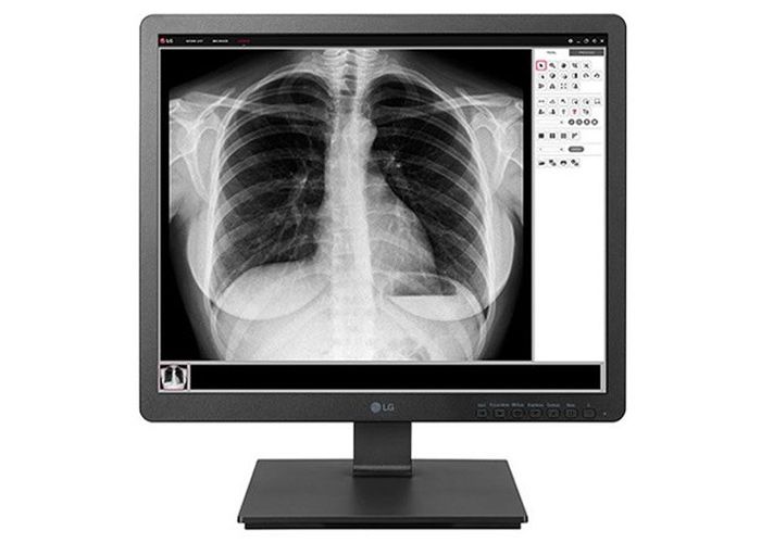 LG 19HK312C-B 1.3 MP Clinical Review Display Monitor