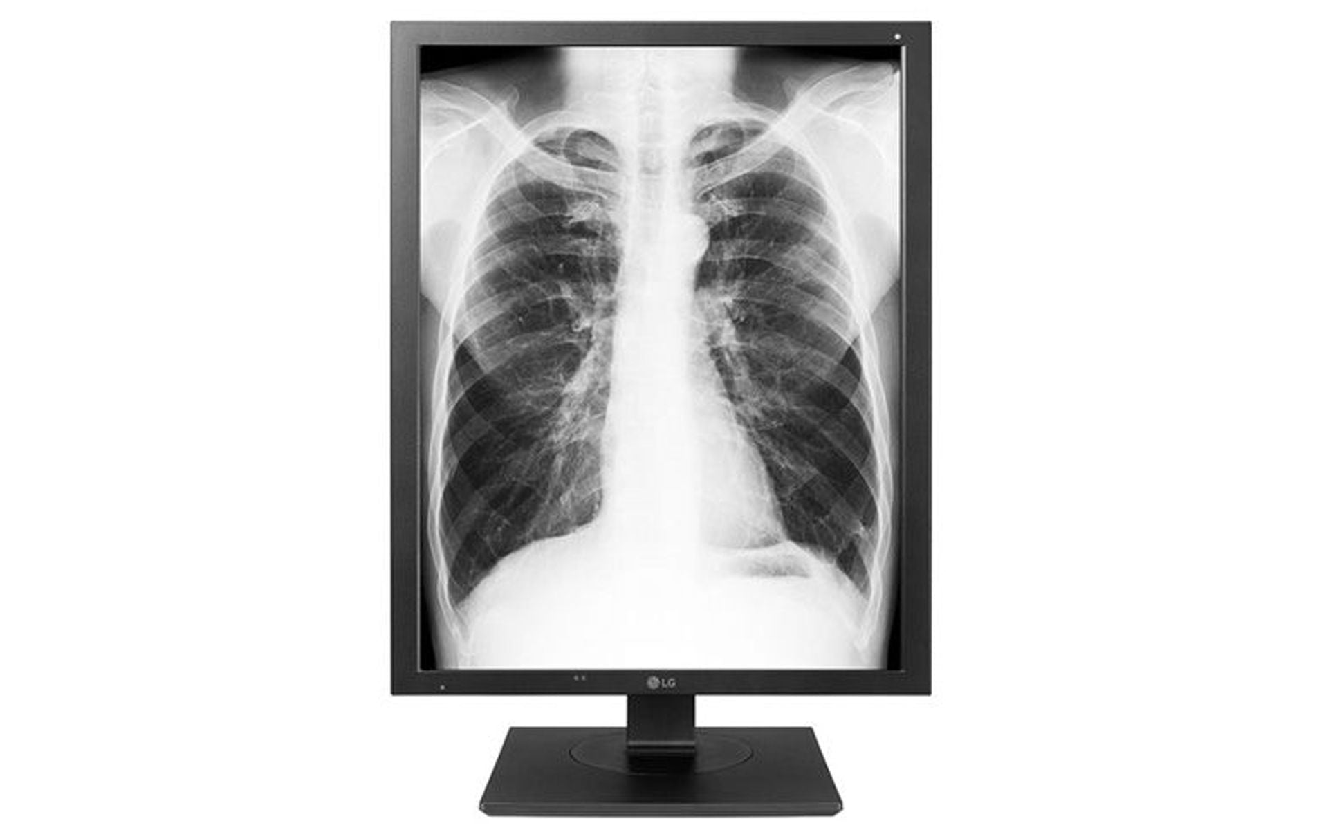 LG 21HK512D-B 3MP Diagnostic Radiology Monitor