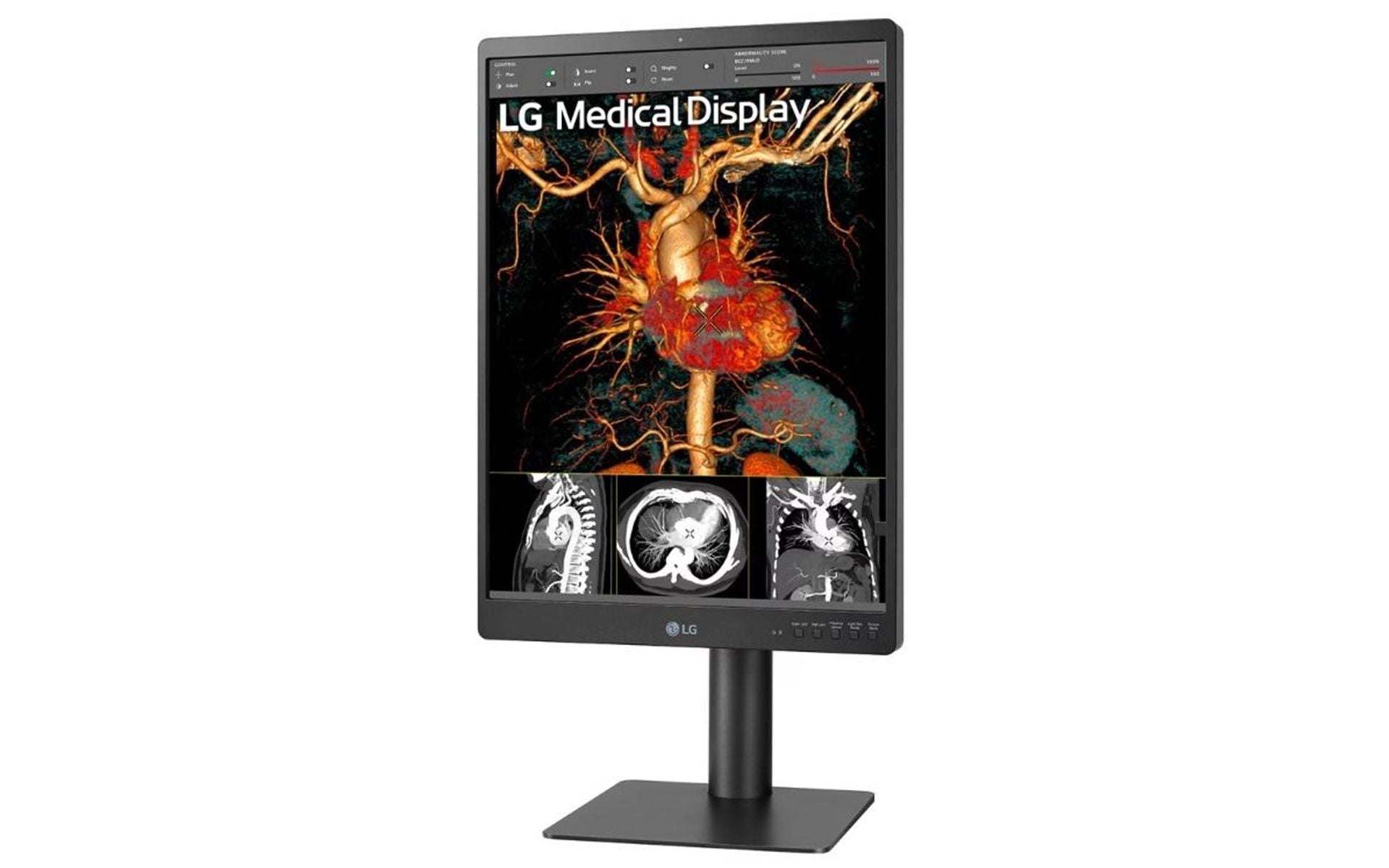 LG 21HQ513D-S 3MP Diagnostic Radiology Monitor
