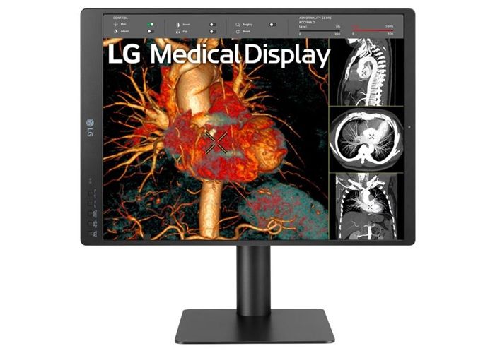 LG 21HQ513D-S 3MP Diagnostic Radiology Monitor