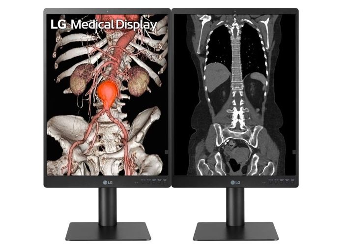 LG 21HQ513D-S 3MP Diagnostic Radiology Monitor