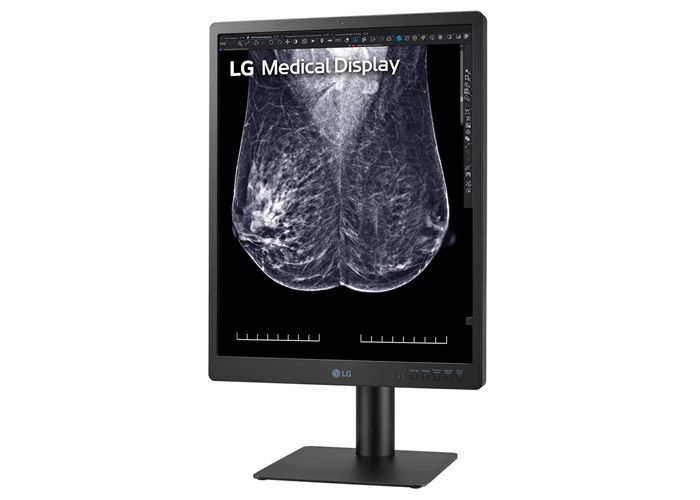 LG 21HQ613D-B 5MP IPS Diagnostic Monitor for Mammography